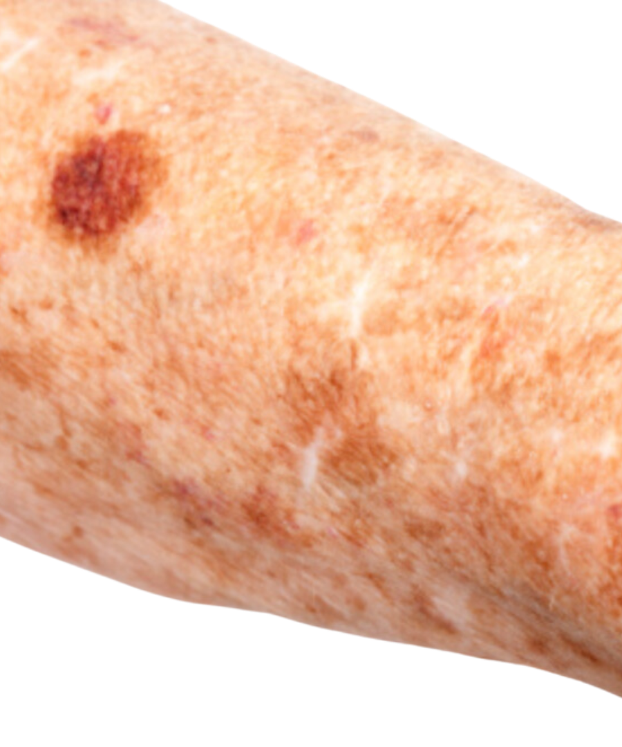 skin